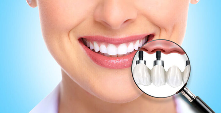 أسهل قبول ماجستير طب أسنان 2026